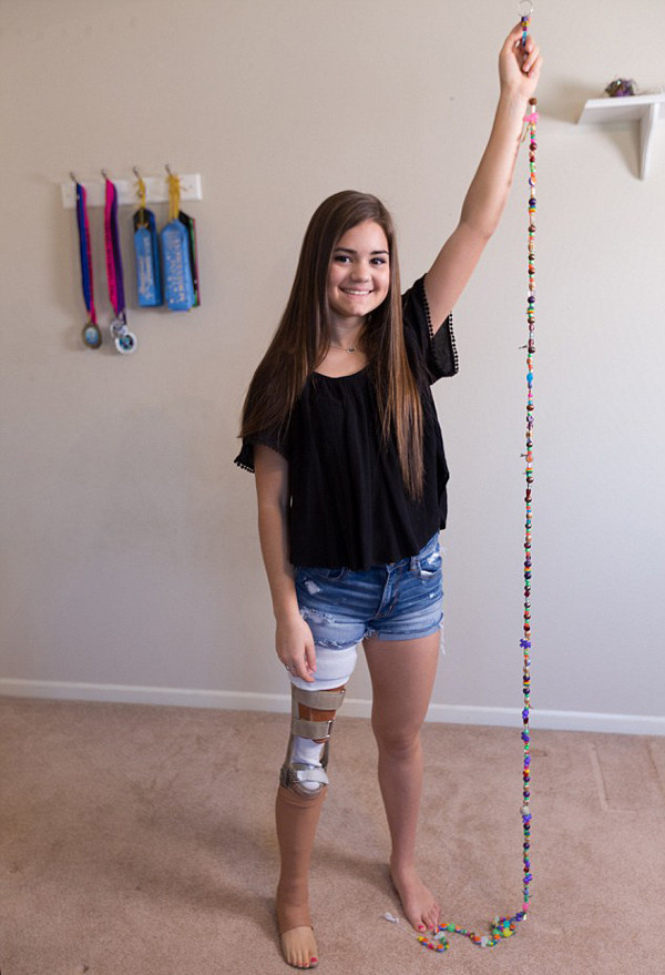 9岁就经历截肢 她用芭蕾舞姿诠释"永不言弃"