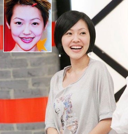 你们能认得出这是谁吗?当年的小s也是牙套妹一枚.